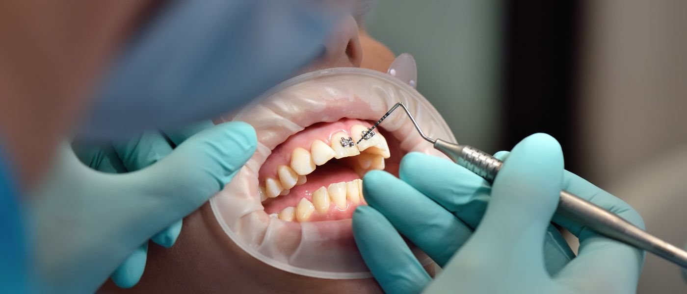 Why a guide does not seat, and how to check before surgery