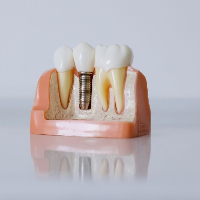 Asked before a first case.