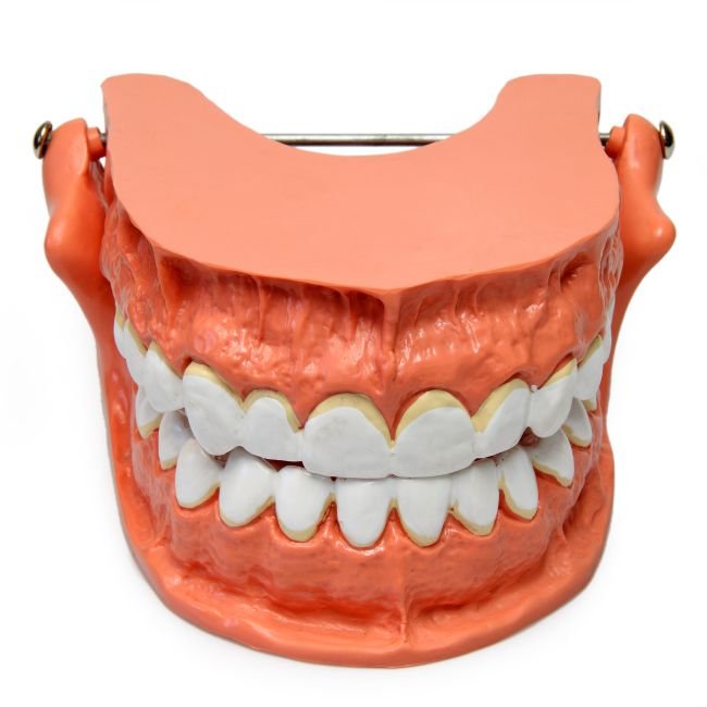 Implant restorations
